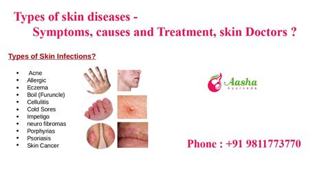 皮膚病|Skin Disorders: Pictures, Causes, Symptoms, and Treatment